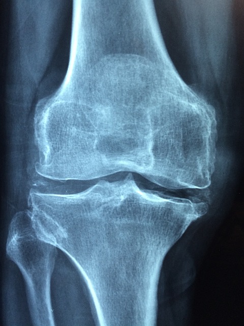 knee_roentgen